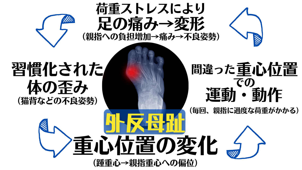 体の歪みと日常生活動作の悪い癖を矯正